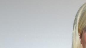 El doctor que vio a Tori tras el suceso le recomendó hacerse un injerto de piel.