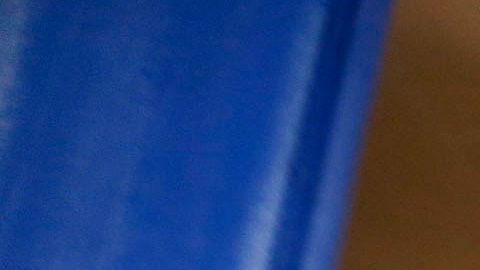 Alberta Esquivel recibe atención para sus problemas de visión.