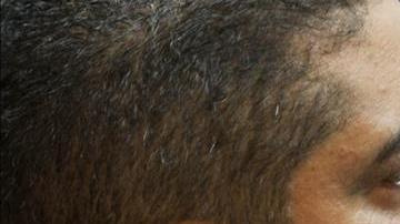 juan carlos monzon la linea guatemala