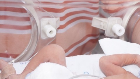 El nacimiento prematuro es aún la principal causa de mortalidad de los bebés en el país.