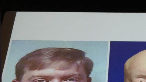 Patrick Hardison antes de sufrir la quemadura, luego con las heridas, y al final tras el trasplante.