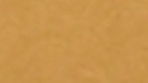 Vicente Garza muestra los daños a la mano que sufrió por una presunta explosion de un cigarillo electrónico. / ARACELI MARTÍNEZ ORTEGA