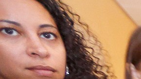 En 2001, Josie y Teresa Álvarez nacieron en Guatemala unidas por la parte superior de la cabeza. /Aurelia Ventura