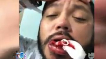 A.B. Quintanilla pierde los dientes