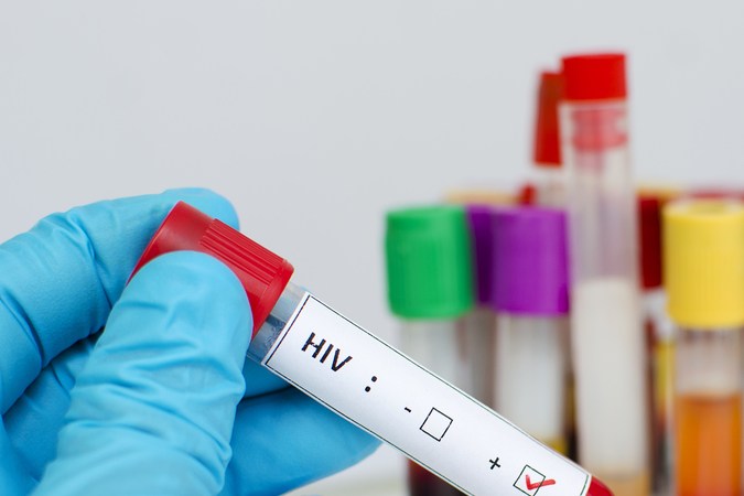 Un chimpancé causó el primer contagio de VIH a un humano: qué debemos saber