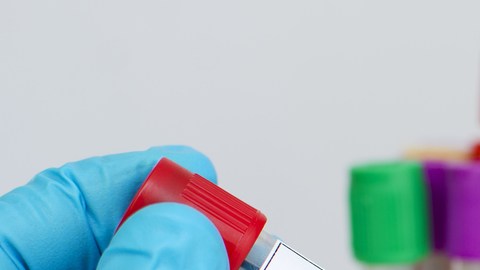 Un chimpancé causó el primer contagio de VIH a un humano: qué debemos saber