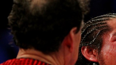 Antonio Margarito es revisado por el réferi durante su combate ante Miguel Cotto en el que su ojo fue seriamente dañado.