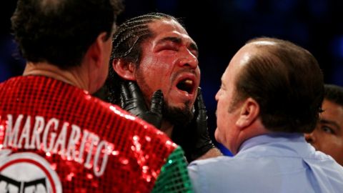 Antonio Margarito es revisado por el réferi durante su combate ante Miguel Cotto en el que su ojo fue seriamente dañado.