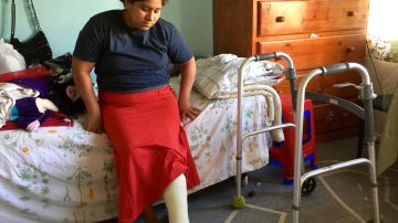 Yoni Ovalle, una inmigrante guatemalteca asegura que el grillete de monitoreo electrónico que le pusieron en un centro de detención familiar en el sur de Texas, le provocó una caída que le lesionó el pie. (Araceli Martínez/La Opinión).