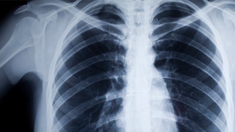 radiografia