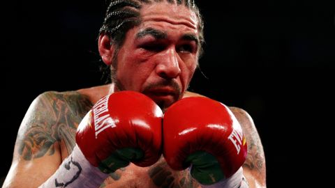 Antonio Margarito sufrió un grave castigo en su ojo derecho en su segunda pelea con Miguel Cotto.