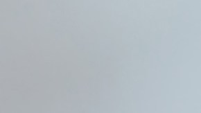 Zonas rurales de Estados Unidos corren el riesgo de una oleada de caries dental