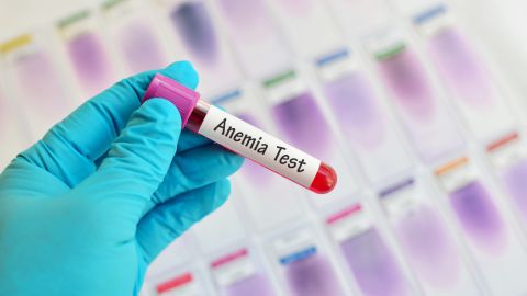 anemia