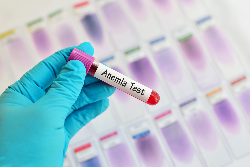 Una anemia puede ser provocada por un medicamento o incluso por un tumor.