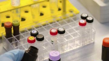 Científicos han descubierto que el virus del zika puede "vivir" en el semen hasta por 6 meses.