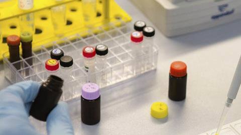 Científicos han descubierto que el virus del zika puede "vivir" en el semen hasta por 6 meses.
