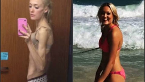 Conflictos no resueltos de su niñez provocaron la anorexia de Tia.