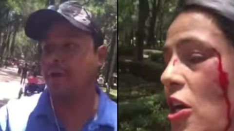 América confesó que sintió mucho miedo.