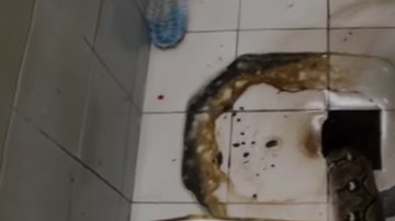 La serpiente le mordió el miembro a la víctima.