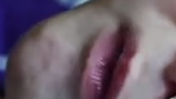 Un  bebé estadounidense nació con una malformación producto de una enfermedad congénita que hizo que su cerebro se desarrollara fuera de la cabeza.