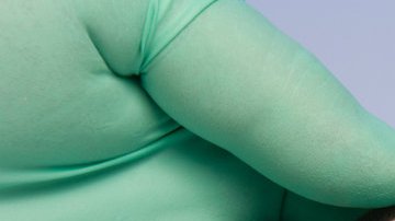 El RH Nulo fue descubierto en la década de los 60.