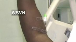 Charles Kinsey estaba desarmado cuando recibió un disparo de la policía en Miami.