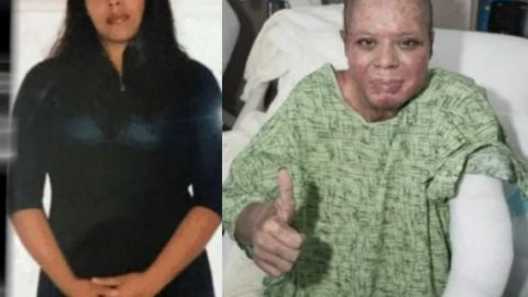 Martha Venegas, de 30 años, sufrió heridas de tercer grado en el 70 por ciento de su cuerpo.