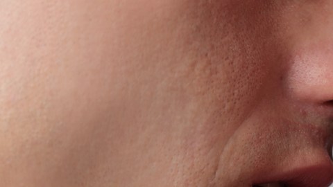 beso