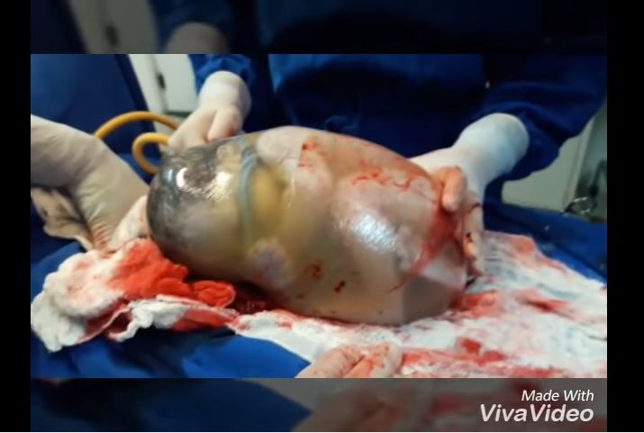 Video: Éste es el parto más impresionante que hayas visto
