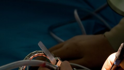 cirugia cerebral