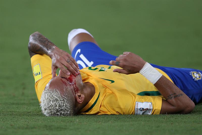 Video Neymar Reg Con Su Sangre La Cancha De Natal Tras Artero Codazo De Duk La Opini n