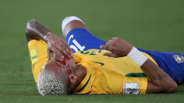 Neymar, bañado en sangre tuvo que ser reemplazado.