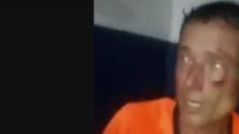 El árbitro Claudio Elichiri tras ser brutalmente golpeado en Ayacucho.