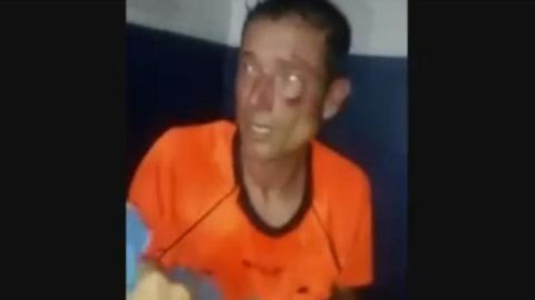 El árbitro Claudio Elichiri tras ser brutalmente golpeado en Ayacucho.