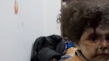 Los menores viven a cada momento el horror de la guerra.