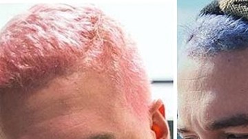 J Balvin