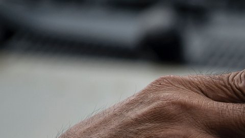 El cáncer de pulmón se asocia al tabaquismo.