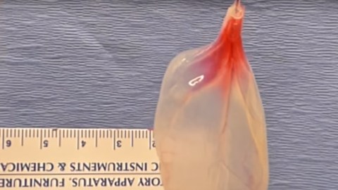 Las espinacas podrían remplazar el tejido vascular humano.