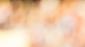 Gareth Bale le pondrá fin a su problema de calvicie