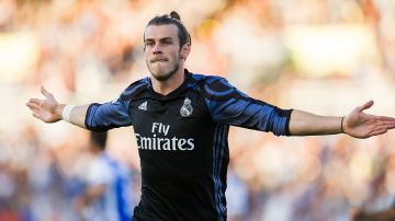 Gareth Bale le pondrá fin a su problema de calvicie