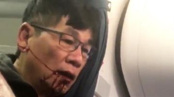 David Dao, el pasajero de United Airlines que terminó con la cara ensangrentada luego de que lo expulsaran de su asiento