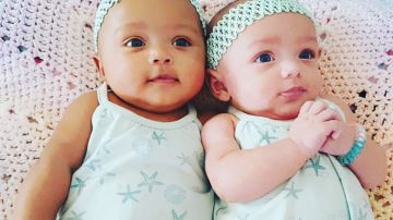 Si los padres son de razas diferentes, los gemelos fraternos o mellizos pueden ser de diferente raza.