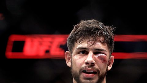 Así quedó "El Pantera" Rodríguez tras el castigo de Edgar.