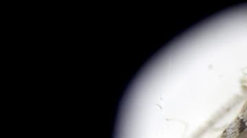 Vista microscópica de la especie Aedes aegypti, transmisor del zika