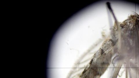Vista microscópica de la especie Aedes aegypti, transmisor del zika