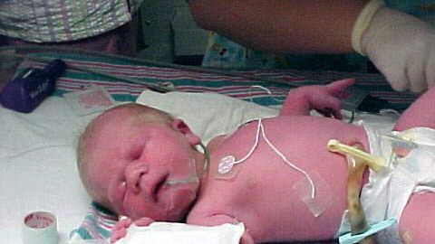 El bebé nació antes de tiempo y está muy bien de salud.