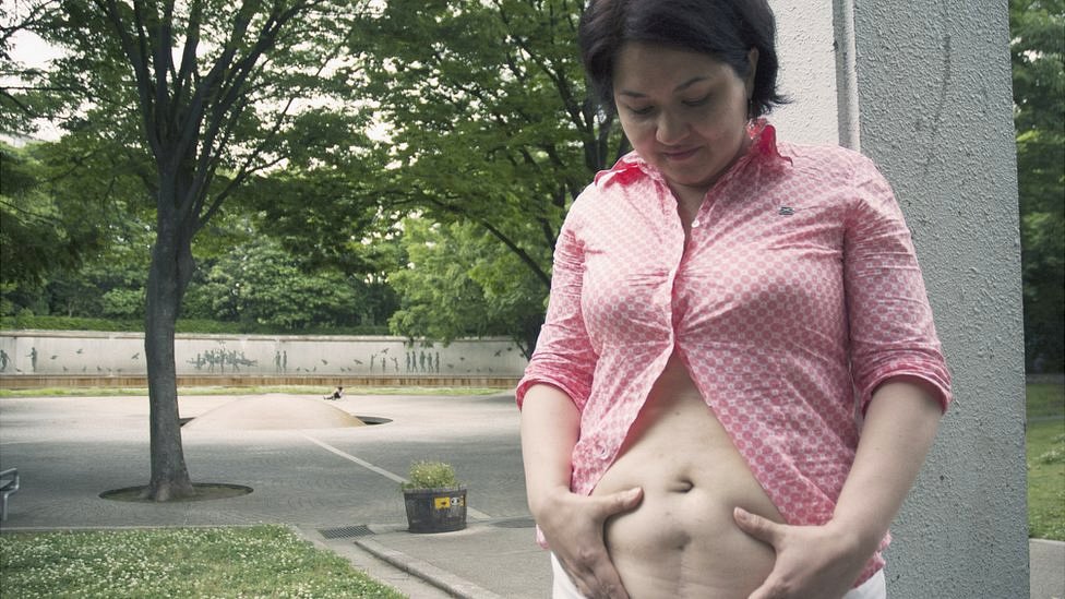 La poderosa razón por la que en Asia las cesáreas siguen siendo verticales