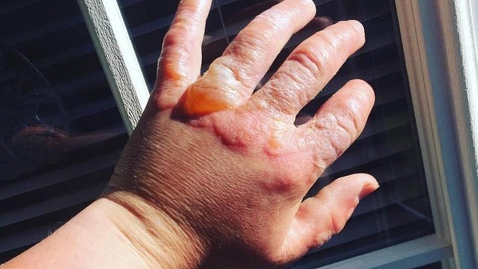 ¿Por qué cortar naranjas, limones y otras plantas al Sol puede dañar o quemarte la piel?