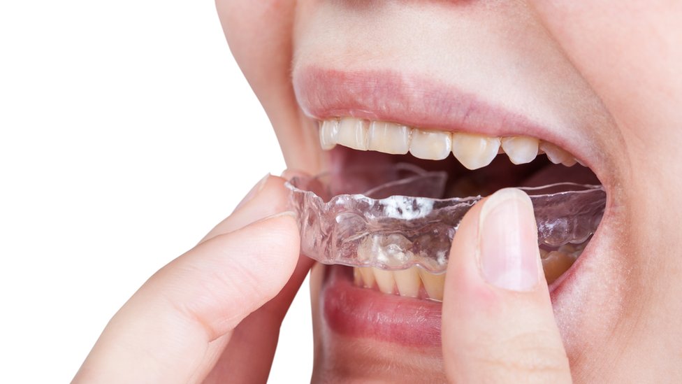 Los problemas “ocultos” detrás del bruxismo