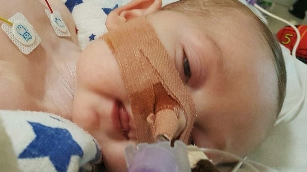 “Sentimos tanto no haberte podido salvar”, dicen padres del bebé Charlie Gard